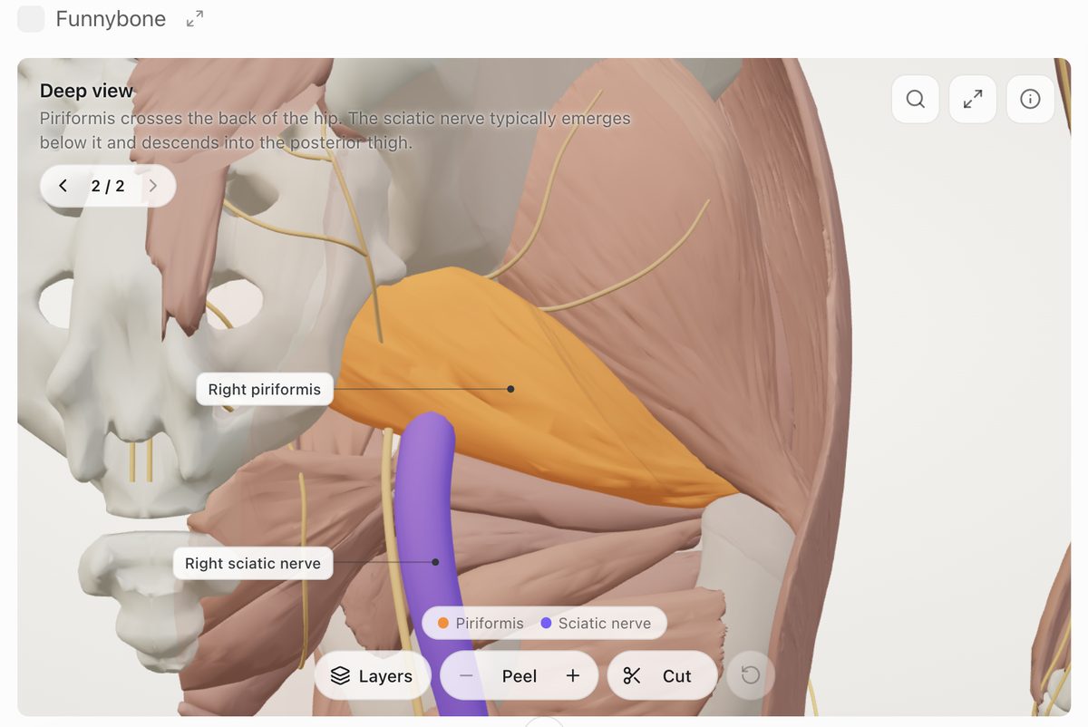 Funnybone in ChatGPT with the right piriformis and sciatic nerve exposed and labelled